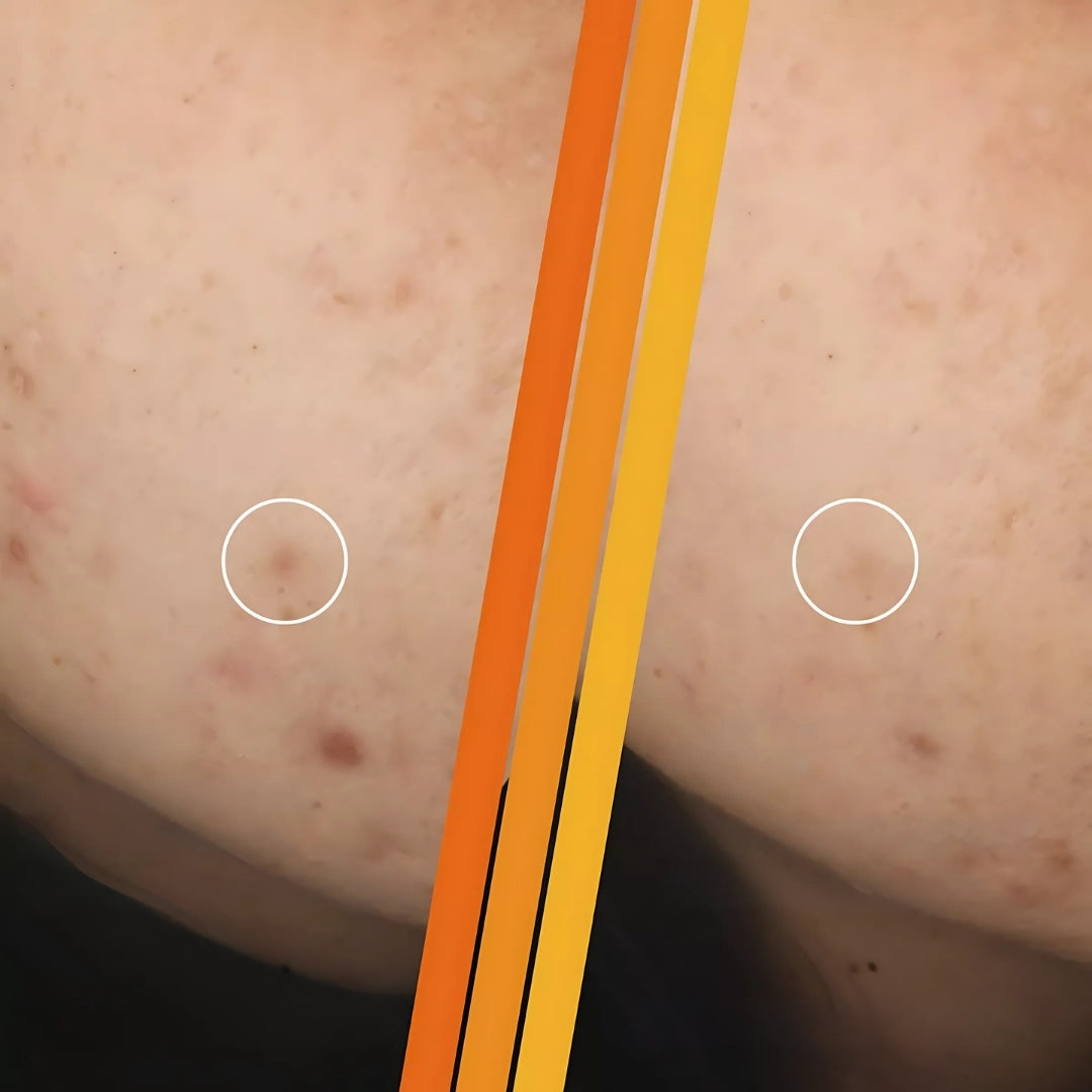 Uniform & Matte Anti-Brand Facial Serum Daily Care Peeling Effect 15ml Garnier